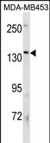 ATP8B3 Antibody in Western Blot (WB)