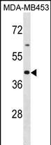 OR2B6 Antibody in Western Blot (WB)