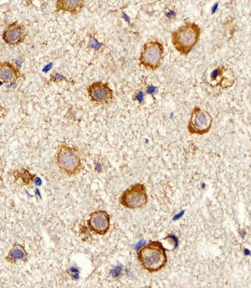 MYH14 Antibody in Immunohistochemistry (Paraffin) (IHC (P))