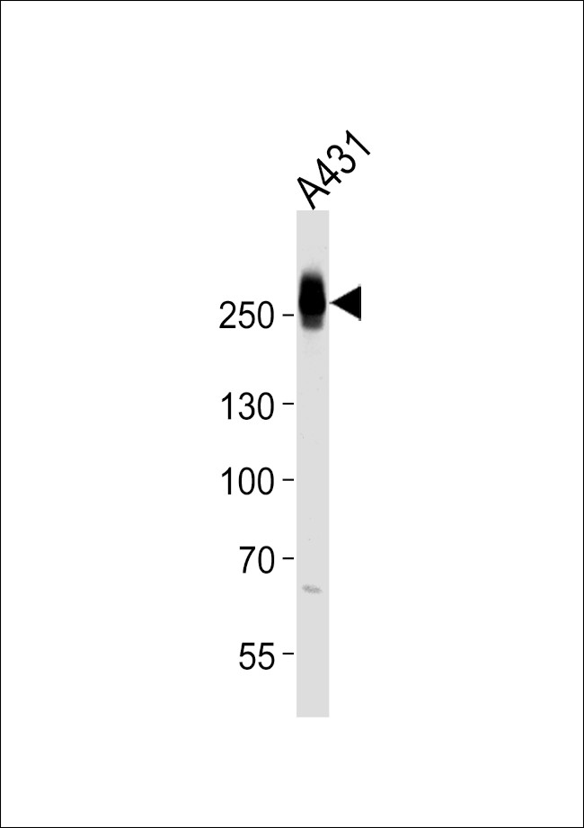 MYH14 Antibody in Western Blot (WB)