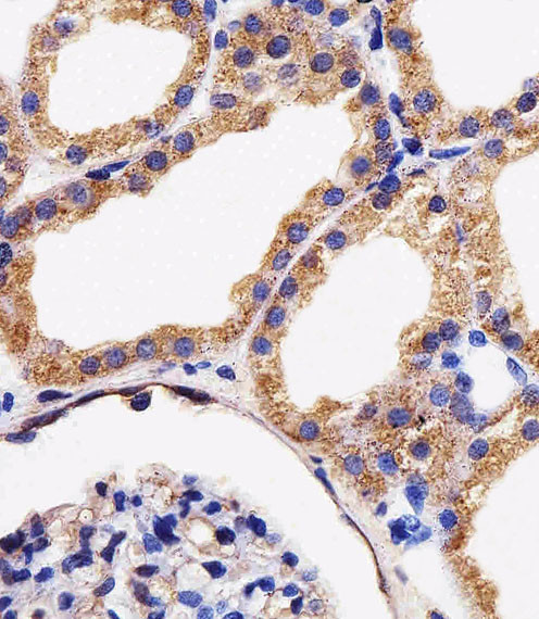 Adenylate Kinase 4 Antibody in Immunohistochemistry (Paraffin) (IHC (P))