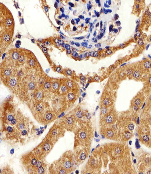 Adenylate Kinase 4 Antibody in Immunohistochemistry (Paraffin) (IHC (P))