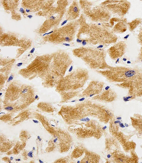 Adenylate Kinase 4 Antibody in Immunohistochemistry (Paraffin) (IHC (P))