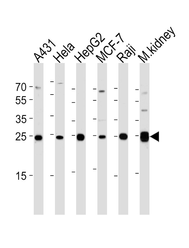 Adenylate Kinase 4 Antibody in Western Blot (WB)