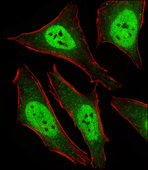 MAD2L2 Antibody in Immunocytochemistry (ICC/IF)