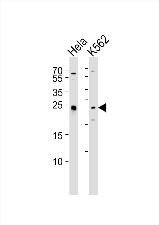 MAD2L2 Antibody in Western Blot (WB)