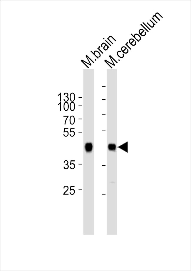 ZDHHC14 Antibody in Western Blot (WB)