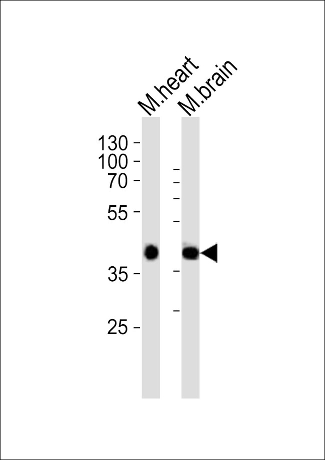 Sbk1 Antibody in Western Blot (WB)