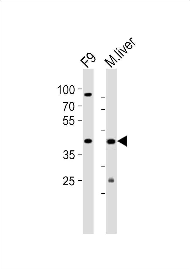 Ubtfl1 Antibody in Western Blot (WB)