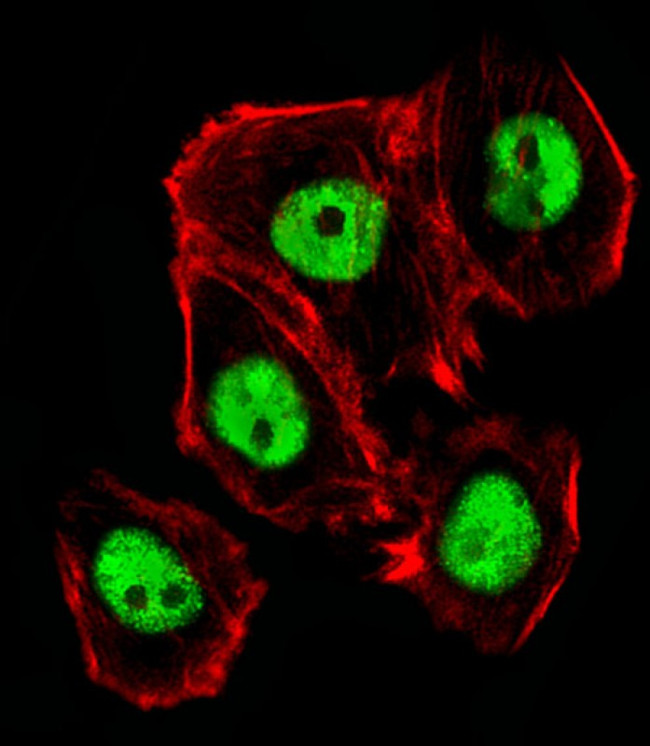 CTR9 Antibody in Immunocytochemistry (ICC/IF)