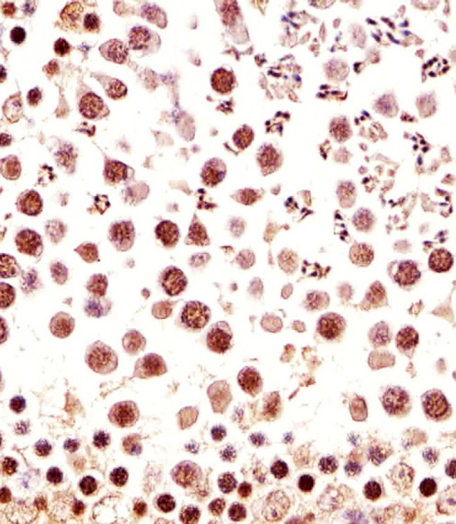 CTR9 Antibody in Immunohistochemistry (Paraffin) (IHC (P))