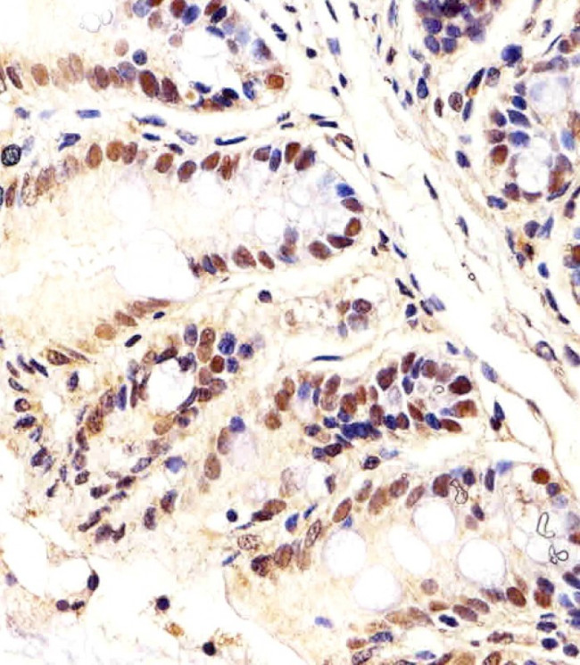 CTR9 Antibody in Immunohistochemistry (Paraffin) (IHC (P))