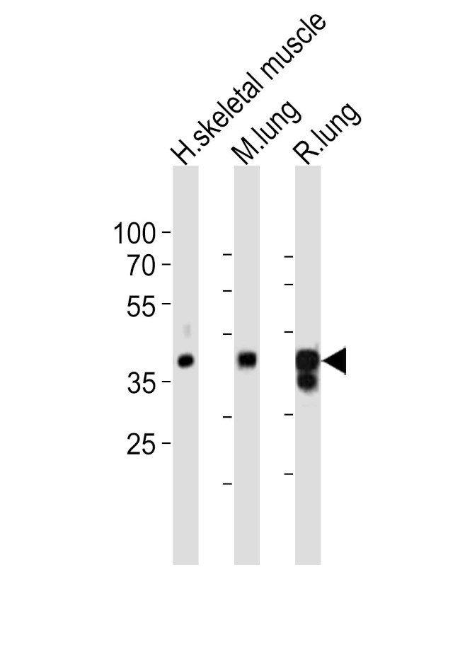 LMCD1 Antibody in Western Blot (WB)