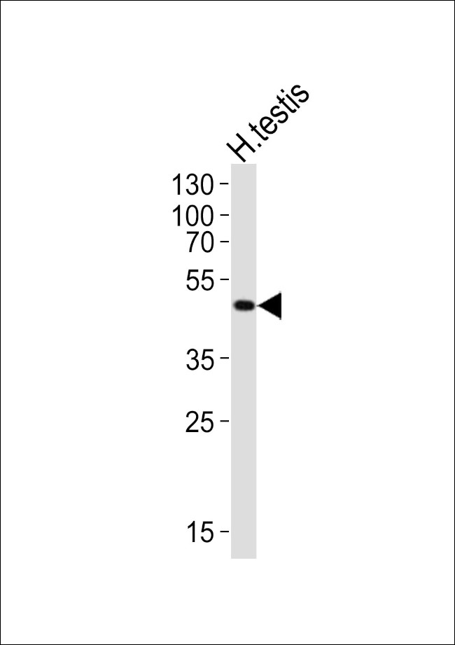 LIPI Antibody in Western Blot (WB)