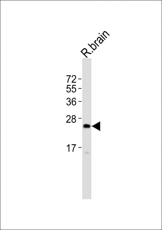 UPK2 Antibody in Western Blot (WB)