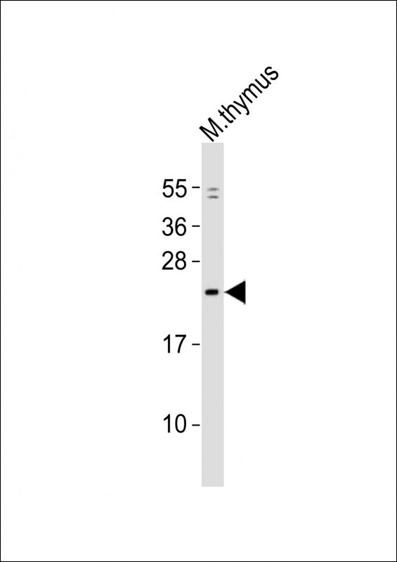 GINS1 Antibody in Western Blot (WB)