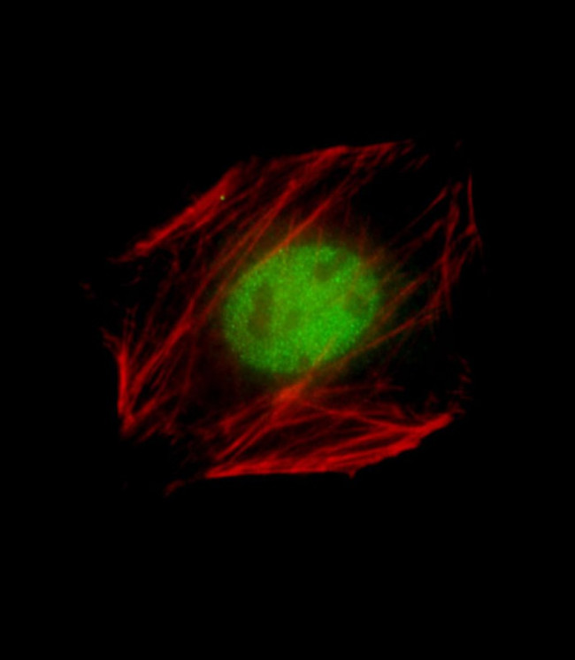 Nkx2.5 Antibody in Immunocytochemistry (ICC/IF)