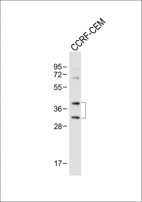 Nkx2.5 Antibody in Western Blot (WB)