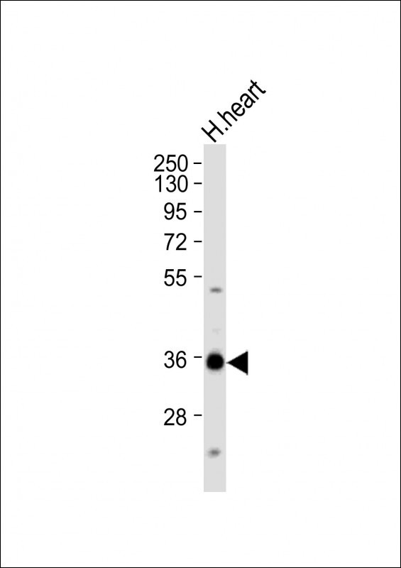 Nkx2.5 Antibody in Western Blot (WB)