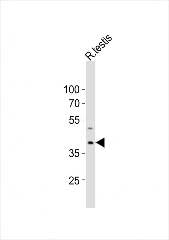 PCGF6 Antibody in Western Blot (WB)