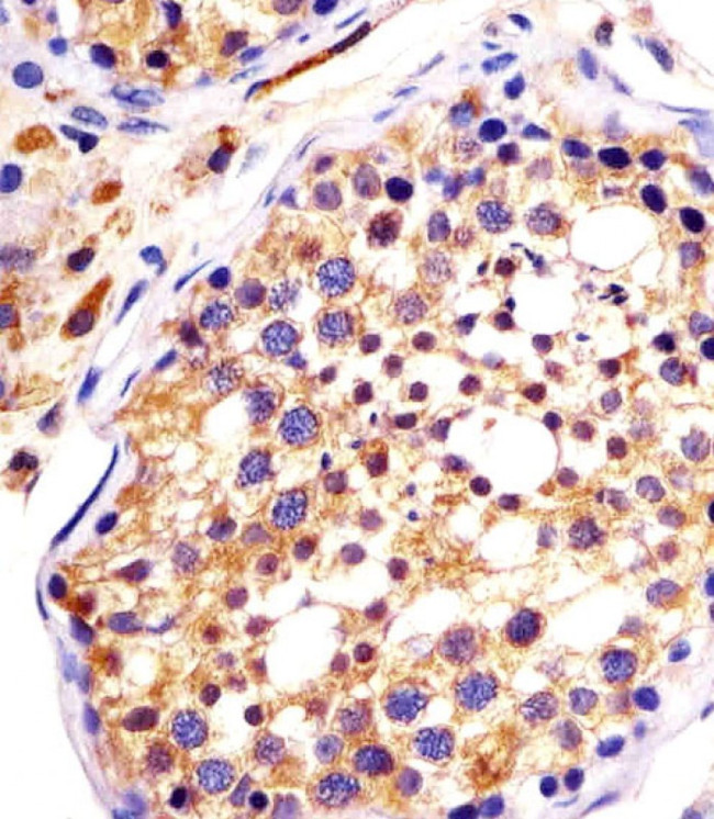 DYNC1H1 Antibody in Immunohistochemistry (Paraffin) (IHC (P))