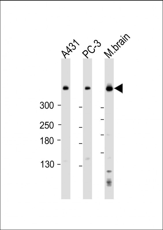 DYNC1H1 Antibody in Western Blot (WB)