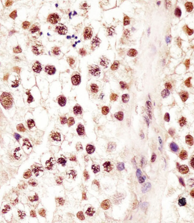 RBMX Antibody in Immunohistochemistry (Paraffin) (IHC (P))