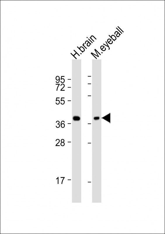 ARR3 Antibody in Western Blot (WB)