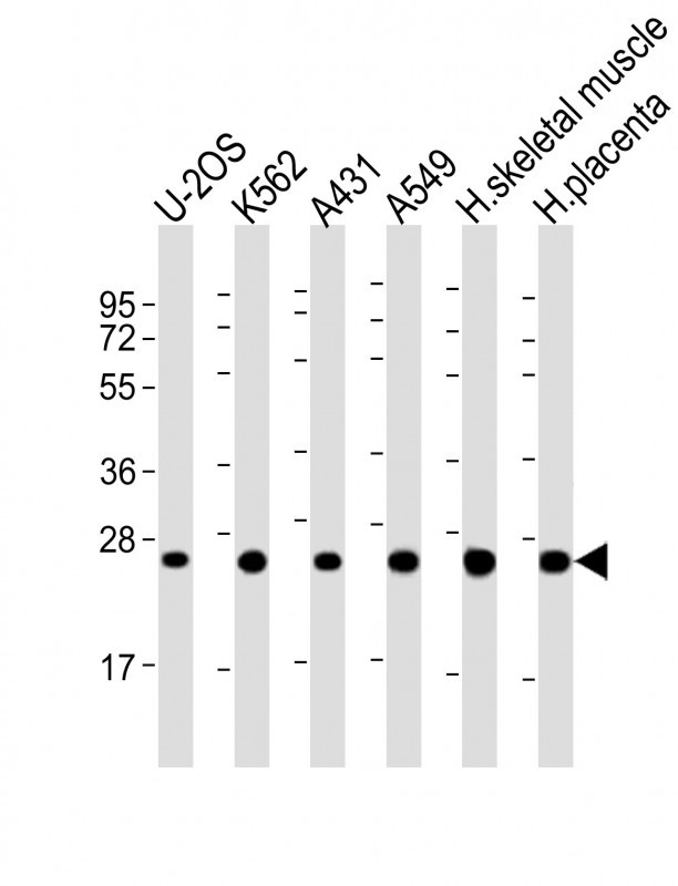 UQCRFS1P1 Antibody in Western Blot (WB)