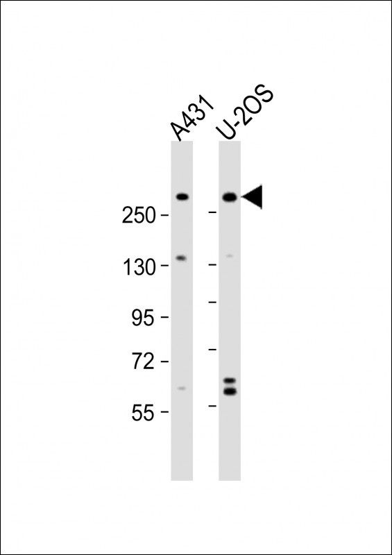 NBAS Antibody in Western Blot (WB)