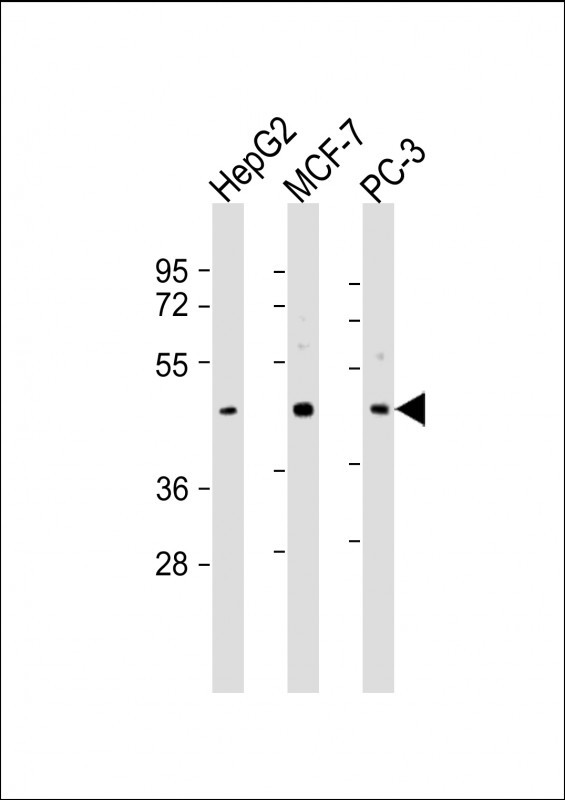 SAPCD2 Antibody in Western Blot (WB)