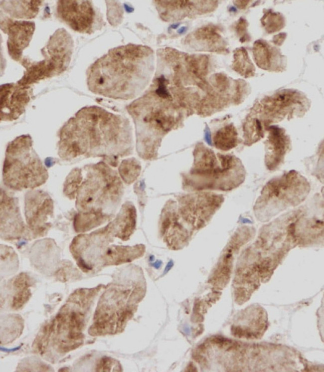 Titin Antibody in Immunohistochemistry (Paraffin) (IHC (P))