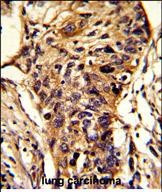 BCKDHA Antibody in Immunohistochemistry (Paraffin) (IHC (P))