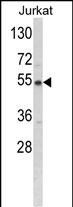 BCKDHA Antibody in Western Blot (WB)