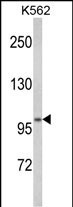 ATP12A Antibody in Western Blot (WB)