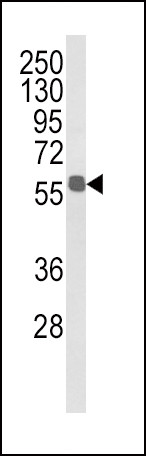 ALDH3B1 Antibody in Western Blot (WB)