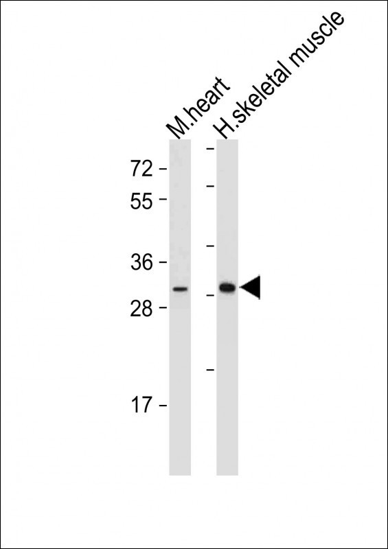 DIO2 Antibody in Western Blot (WB)