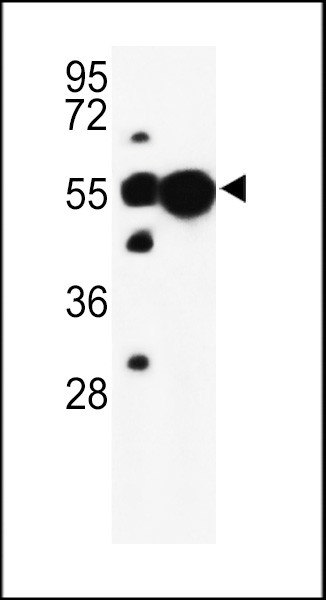 UBAP1 Antibody in Western Blot (WB)