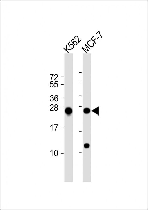 PSMB1 Antibody in Western Blot (WB)