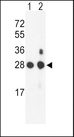 PSMB1 Antibody in Western Blot (WB)