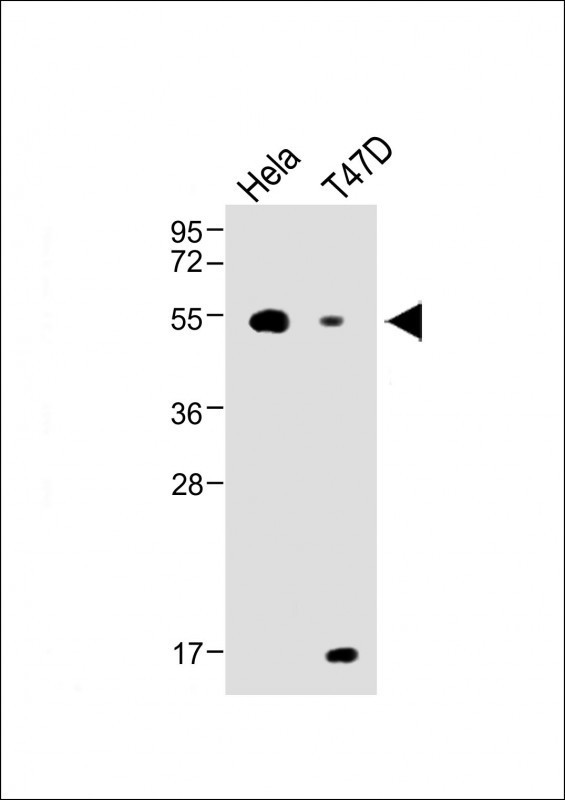 B4GALT1 Antibody in Western Blot (WB)