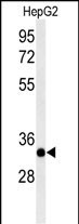 ACER3 Antibody in Western Blot (WB)