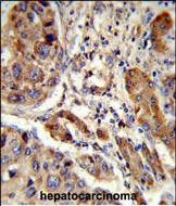 EBP Antibody in Immunohistochemistry (Paraffin) (IHC (P))