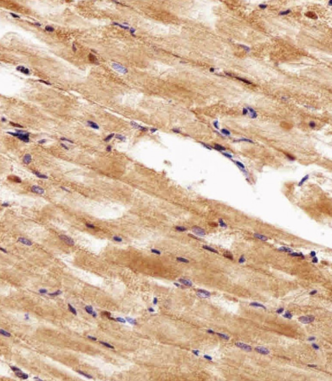 HSP90 alpha Antibody in Immunohistochemistry (Paraffin) (IHC (P))