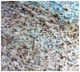 TWIST1 Antibody in Immunohistochemistry (IHC)