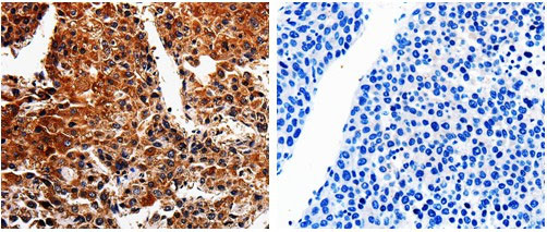 ABCB8 Antibody in Immunohistochemistry (Paraffin) (IHC (P))