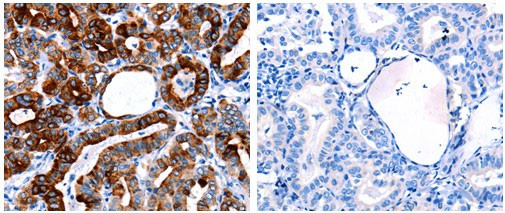 CLEC4D Antibody in Immunohistochemistry (Paraffin) (IHC (P))