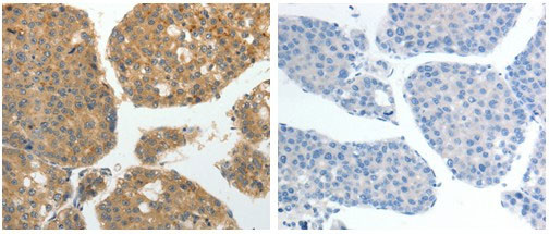 GRK4 Antibody in Immunohistochemistry (Paraffin) (IHC (P))