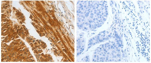 CFHR1 Antibody in Immunohistochemistry (Paraffin) (IHC (P))