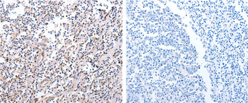 PDCD10 Antibody in Immunohistochemistry (Paraffin) (IHC (P))